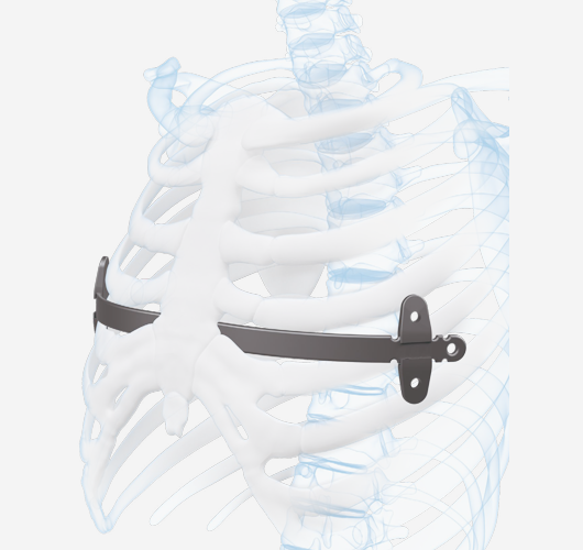 生物型全髋关节